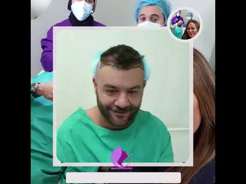 زراعة الشعر للفنان و النجم اللبناني الصديق رايانتقنية السفير