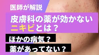 皮膚科の薬が効かないニキビとは？他の病気？薬があってない？【医師が解説】