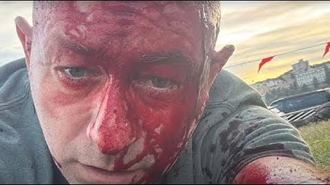 Making Sense of the Bondi Beach Massacre