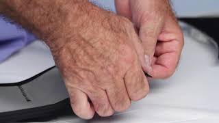 Exos Humeral Fracture Brace Application