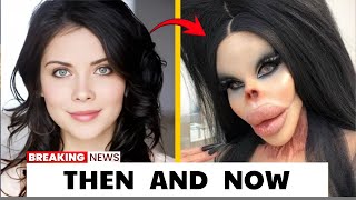 15 Plastic Surgery Disasters That Left Celebrities Unrecognizable  Then and Now 2026