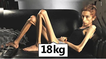 O que é ser uma pessoa diferente?