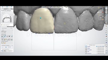 Use the mirror feature 3Shape