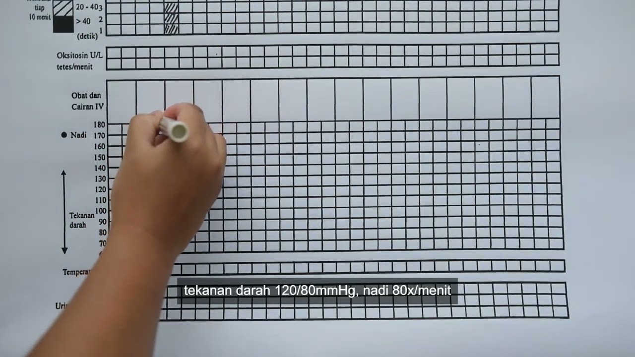 PANDUAN SKILLS LAB PENGISIAN PARTOGRAF FAKULTAS KEDOKTERAN UNIMUS