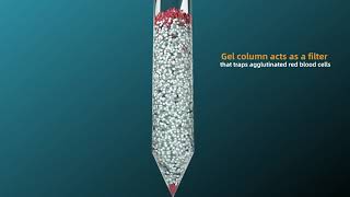 Fully Automated Blood Grouping System BT-70 screenshot 4