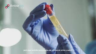 Nitritos en orina HD Que Es Nitrite En La Orina