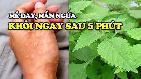 Mề Đay, Dị Ứng Mẩn Ngứa sẽ khỏi ngay SAU 5 PHÚT với bài thuốc đơn giản từ lá KINH GIỚI