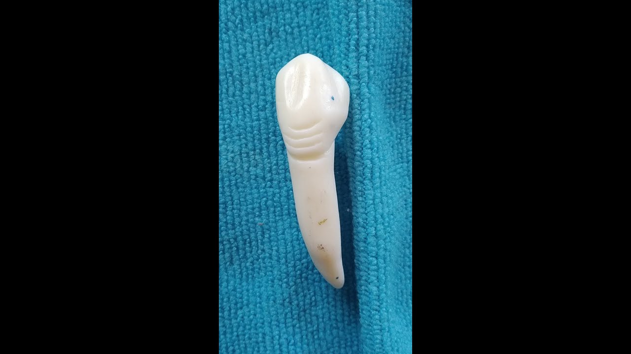 Tallado en jabon Canino Inferior Izquierdo Pieza 33 parte 2