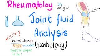 Joint fluid analysis (Pathology) - Joint Aspiration - Rheumatology