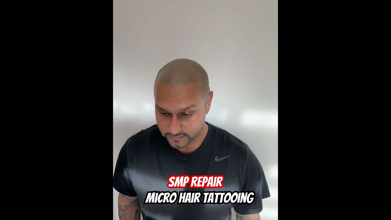 Scalp micropigmentation repair 