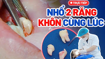 [Cận Cảnh] Quy Trình Nhổ Răng Khôn Mọc Lệch| Nhổ 2 Răng Khôn Cùng Lúc – Giải Cứu Răng Số 7