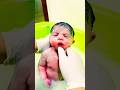 birth blog #baby #cutebaby #newbornbaby #ytshorts #cute #trending #birthvlog #twins
