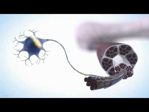 Video: Spinraza - Navodila Za Uporabo Zdravila, Cena Injekcij, Pregledi