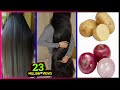 How To Grow Long and Thicken Hair Faster With Onion & Potato !! Super Fast Hair Growth Challenge!