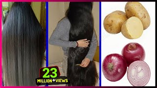 How To Grow Long and Thicken Hair Faster With Onion & Potato !! Super Fast Hair Growth Challenge!