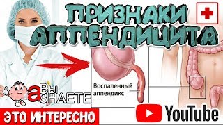 💊  5 СИМПТОМОВ АППЕНДИЦИТА