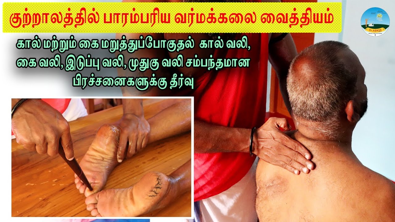 🔴கால், கை மறுத்துப்போகுதல்🔴இடுப்பு வலி, முதுகு வலி சம்பந்தமான பிரச்சனைகளுக்கு தீர்வு ☎️9363408860