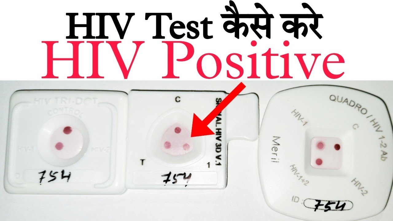 HiV Test HIV positive test Hiv test kaise kare HiV test in lab 