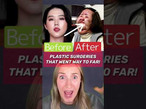 PLASTIC SURGERIES GONE WAY TO FAR!😳 (PART 3)