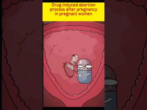 Drug induced abortion process after pregnancy in pregnant women #asmr #shorts