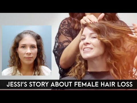 Jessi’s Story About Female Hair Loss