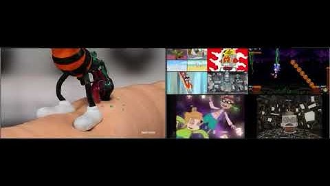 Up To Faster 11 Parison