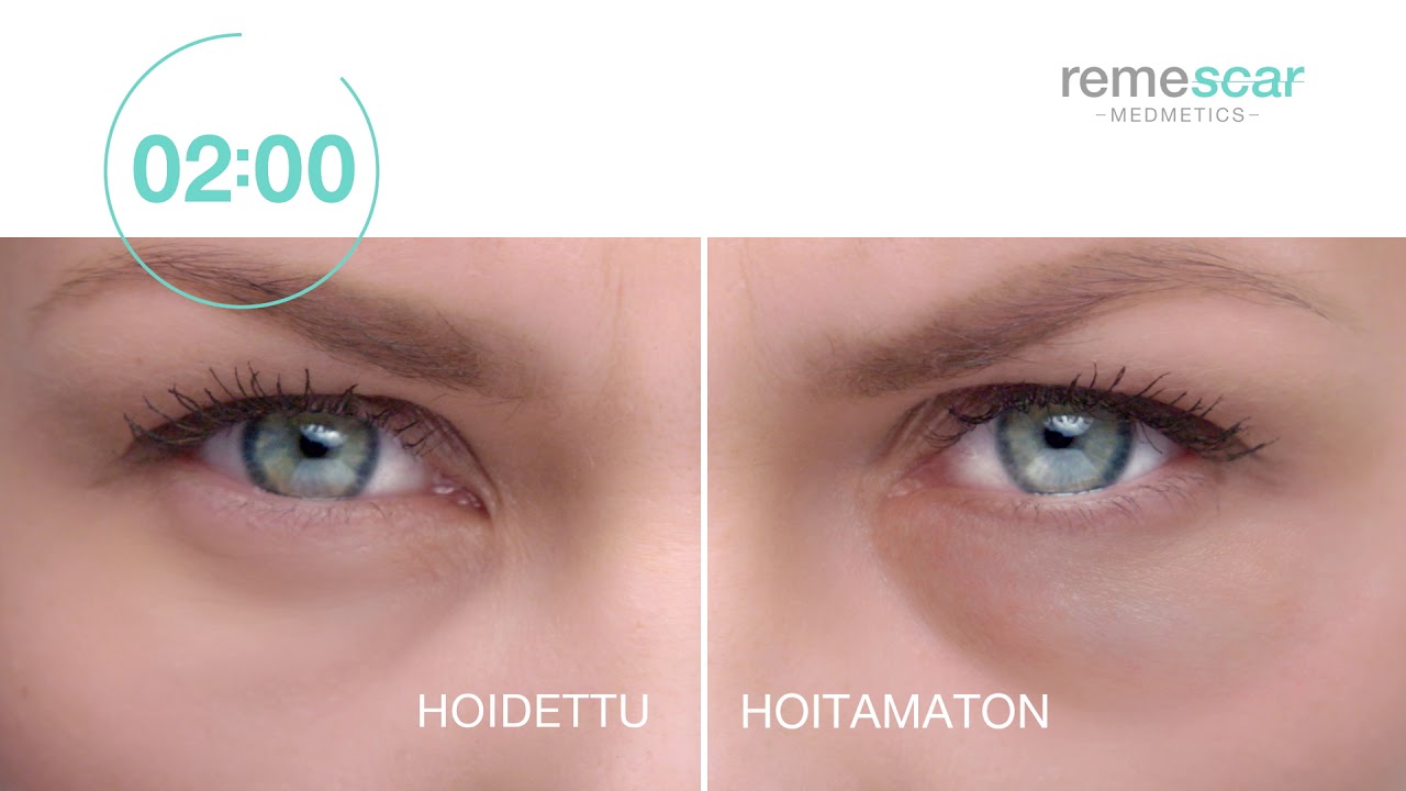 remescar dark circles remescar dark circles