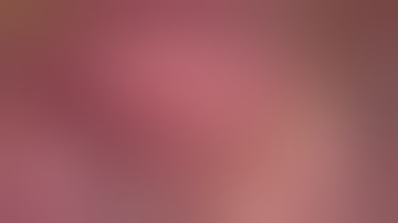 Laparoscopic liver resection and radiofrequency for colorectal liver metastasis