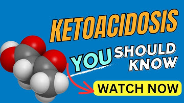 What is ketoacidosis - Demystifying Ketoacidosis: Understanding Causes, Symptoms, and Prevention
