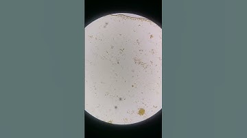 Poop under the microscope #laboratory #mls #microscope #medtechstudent #cls #fecalysis #stool