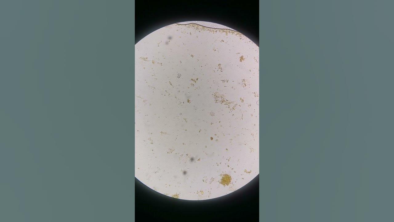 Poop under the microscope laboratory mls microscope medtechstudent