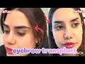 Amazing Eyebrow Transformation