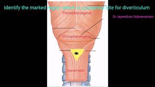 ENT Image based question 73