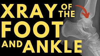 Bones of the Foot and Ankle | Radiology anatomy part 1 prep | Foot and ankle anatomy | X-ray