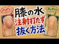 膝の水を注射打たずスッキリ抜く!座りながら簡単にできる膝の水抜き法3選