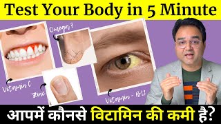 5 मिनट में पहचानें आपके शरीर में कौनसे विटामिन की कमी है ? | Signs of Nutritional Deficiency