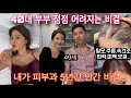 [5월 24일 오픈] 6년째 먹는 젊어지는 올인원 동안영양제 국내 최초 식약처 4중기능성 콜라겐,엘라스틴,히알루론산,비오틴 최대함량 한병에!! 공동구매