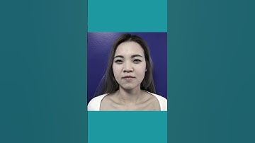 Khác biệt nhưng vẫn tự nhiên sau combo nâng mũi + độn cằm + cắt mí