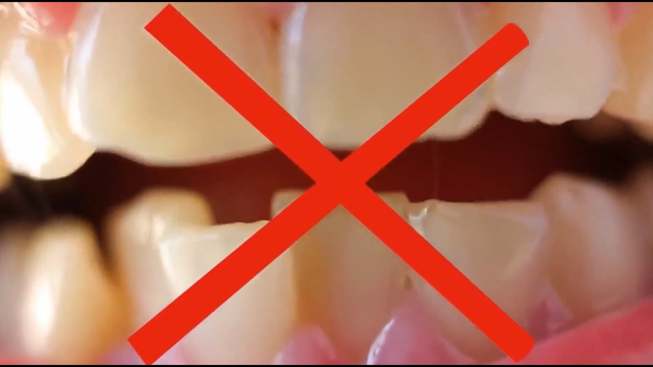 Dentivive Review: Visiting Dentists May Do More Harm Than Good And Actually Puts Your Life At Risk!