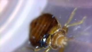 Watch The Best Bed Bug Video - Bed Bug Magnified 100X