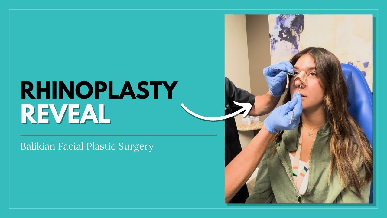 She's ONE WEEK Out From Rhinoplasty!