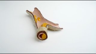 Blocked Coronary Arteries & Coronary Artery Disease A Specialists Insight