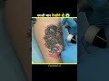 Tattoo Ink Remove 😱 Real Process #shorts
