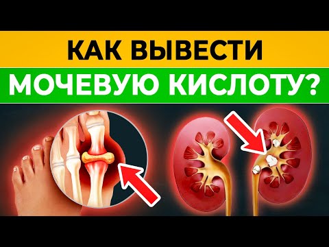 Одно движение и МОЧЕВАЯ КИСЛОТА выйдет из организма! Секрет китайских врачей от БОЛЬНЫХ СУСТАВОВ!