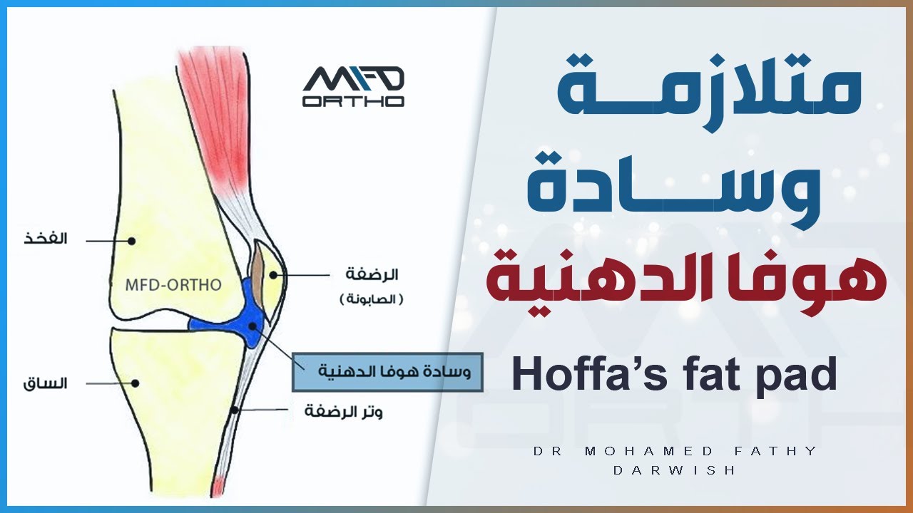 متلازمة وسادة هوفا الدهنية - Hoffa's Fat Pad د. محمد فتحي در