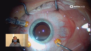 Retinal Detachment | Vitrectomy | Patient Testimonials | Tijuana, Baja California Mexico