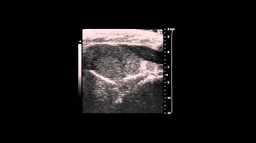 USphere™ Prime in Mice Myocardial Perfusion Imaging (on VisualSonics Vevo2100)