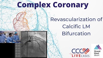 Revascularization of Calcific LM Bifurcation January 15, 2019