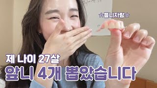 앞니임플란트 발치 3일차 후기🦷ㅣ틀니구경하세요~~~