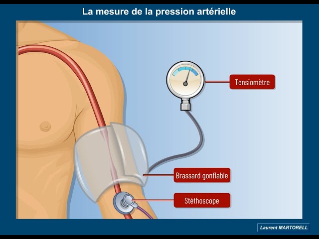 Quel est le principe de la mesure de la pression artérielle? 